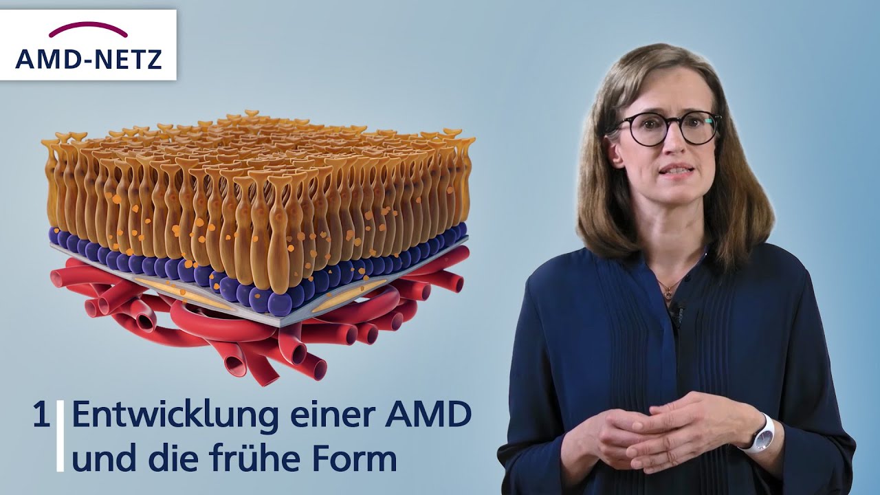 1. Entwicklung einer AMD und die frühe Form