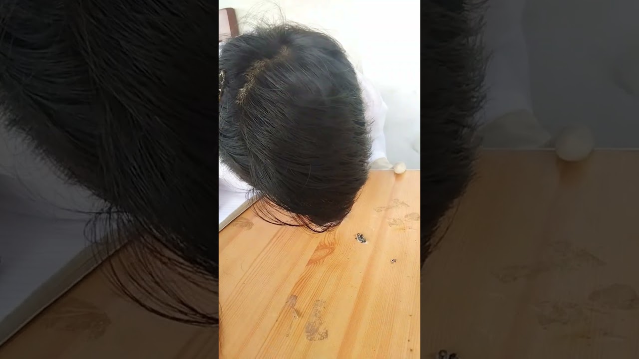 IGNITION TEST FOR TEXTILE FIBER, ANIMAL HAIR, AND HUMAN HAIR(FORENSIC CHEMISTRY AND TOXICOLOGY)