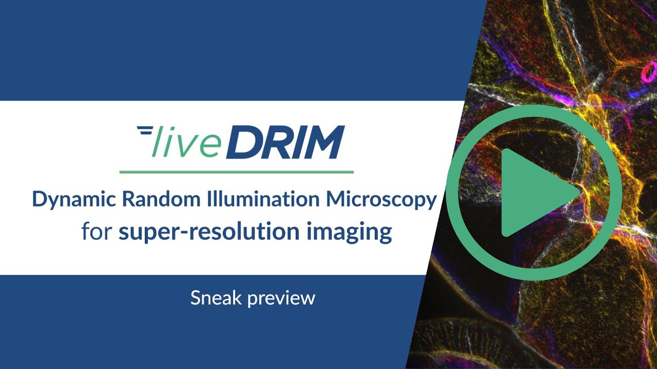 liveDRIM - Dynamic Super-Resolution Imaging