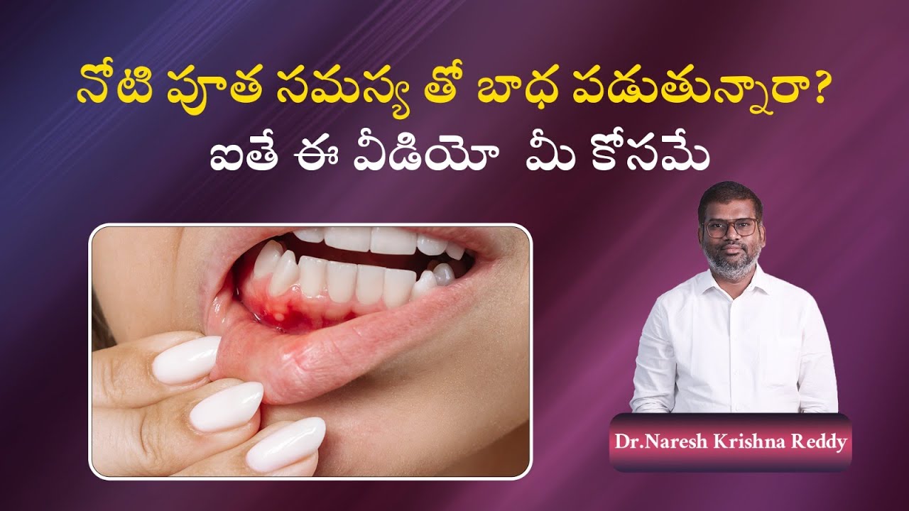 Are you constantly troubled by painful Mouth Ulcers | Krishna Dental Hospitals | +91-8886845454