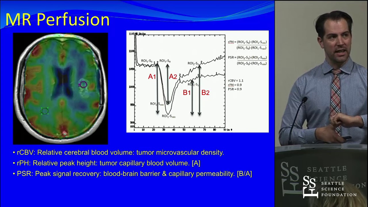 Imaging Advances in Malignant Gliomas - Jerome Graber, MD, MPH