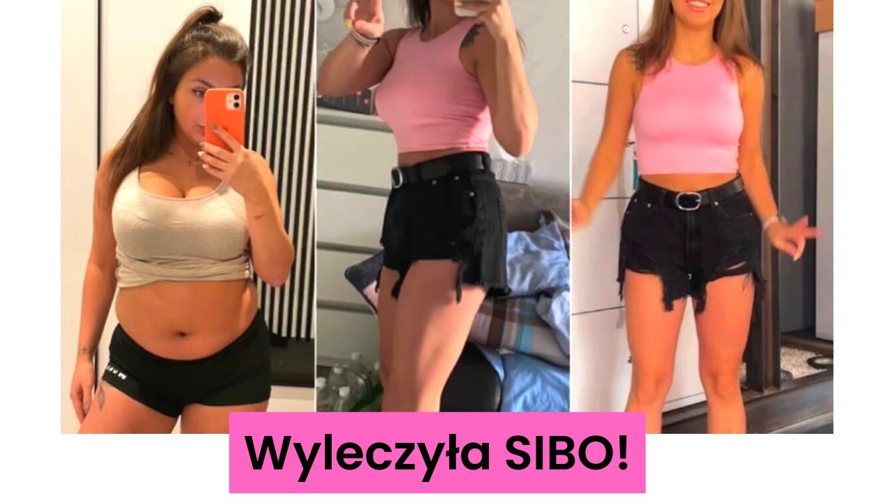 Wyleczyła SIBO i odzyskała radość życia! || Rozmowa z moją pacjentką 👨‍⚕