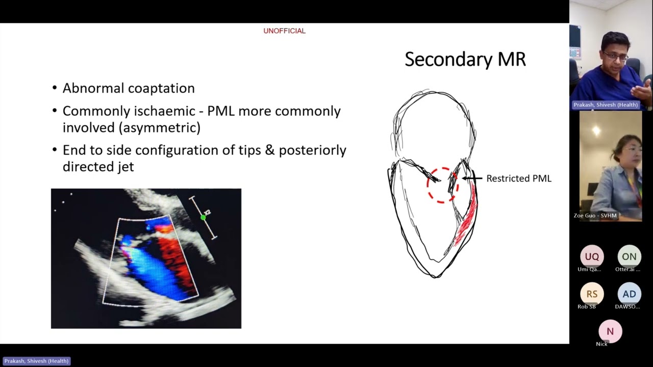 Mitral Regurgitation
