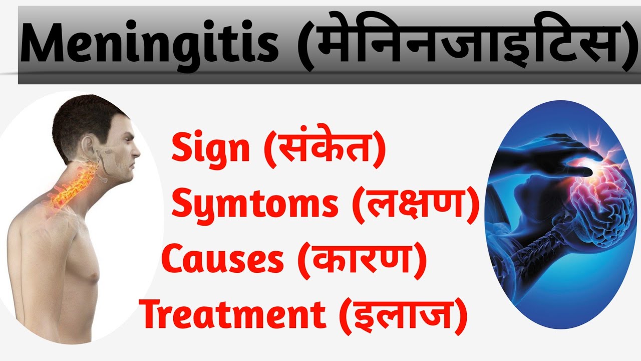 Meningitis in hindi, symptoms,  Causes,  Sign, Route of infection,  Treatment , Type of Meningitis 