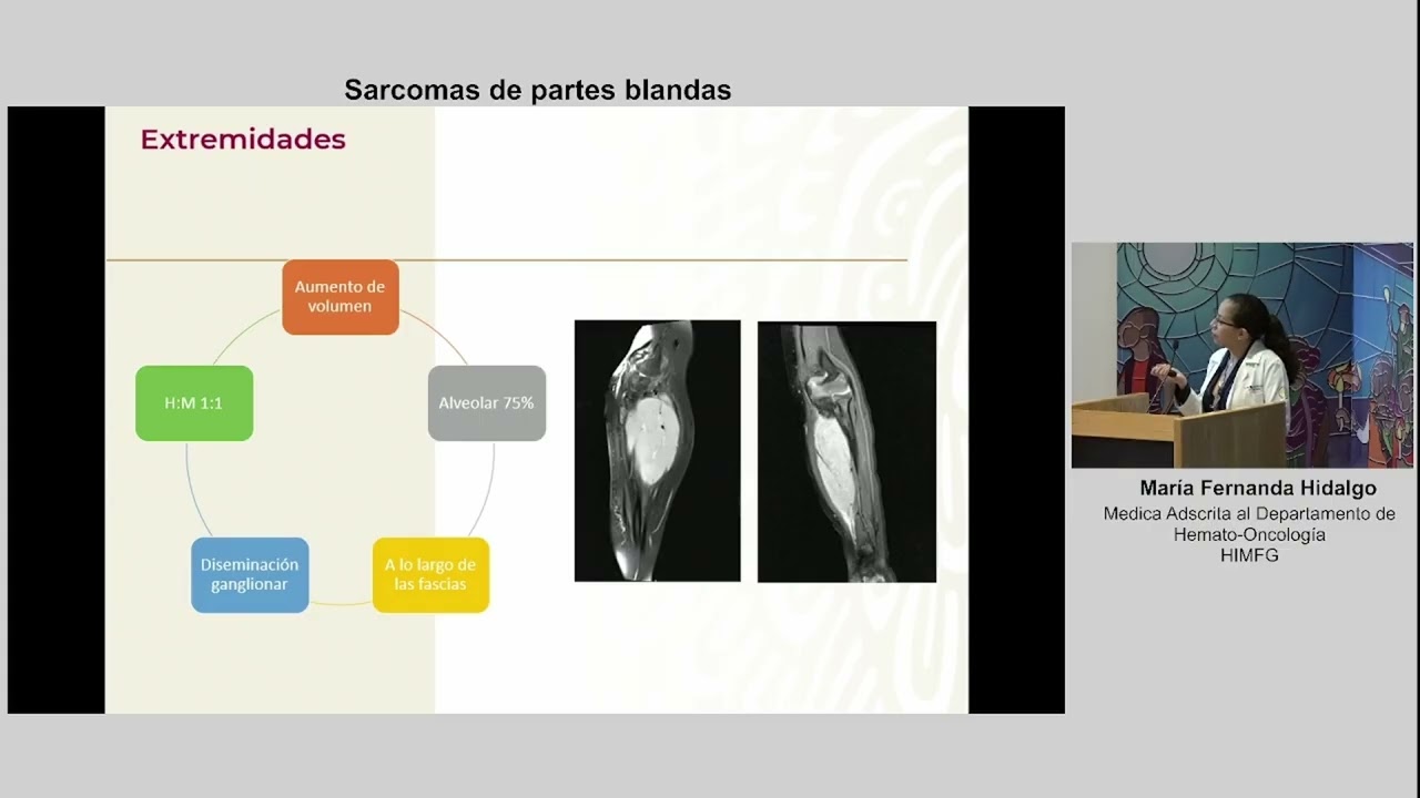 15  SARCOMAS DE PARTES BLANDAS
