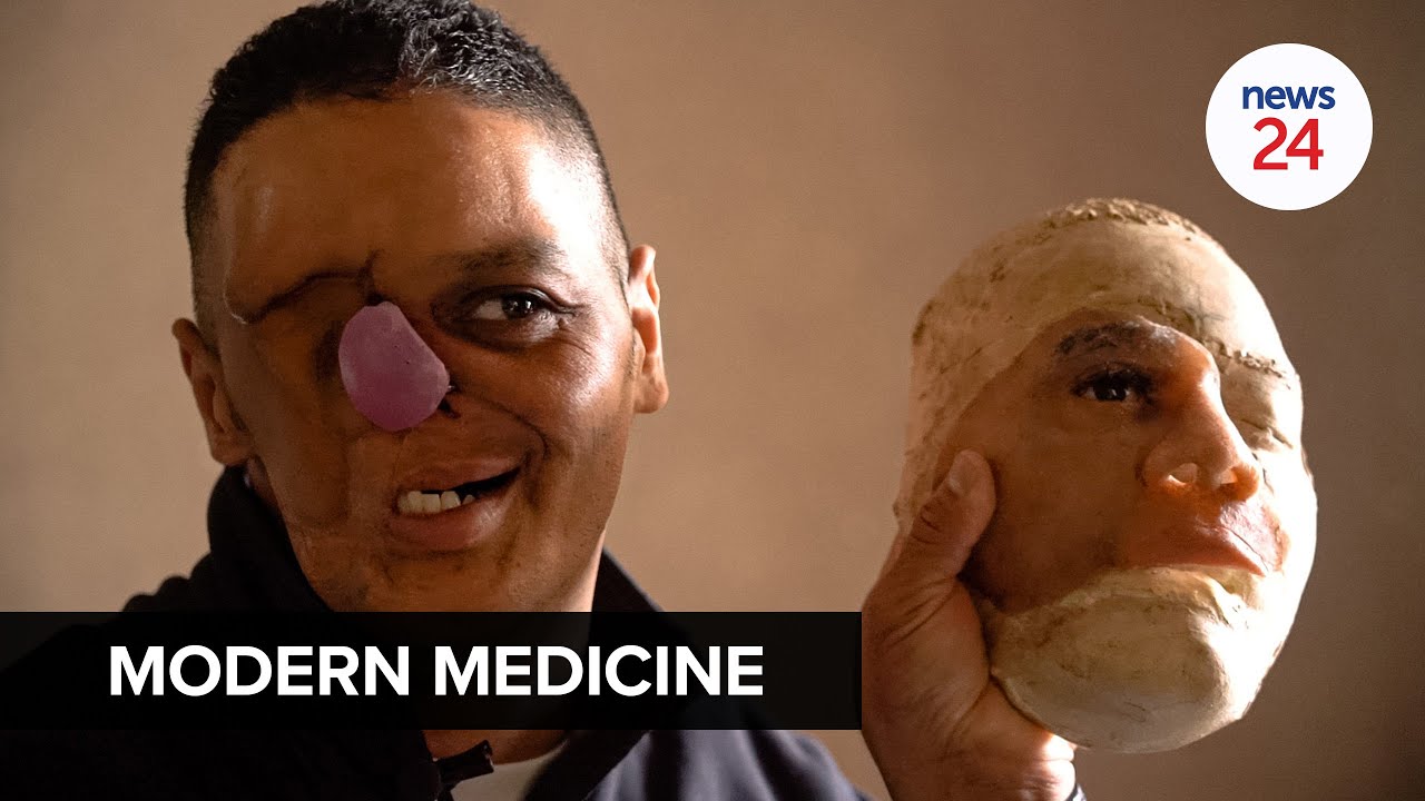 WATCH | Modern Medicine: Cancer survivor's new face brings renewed hope