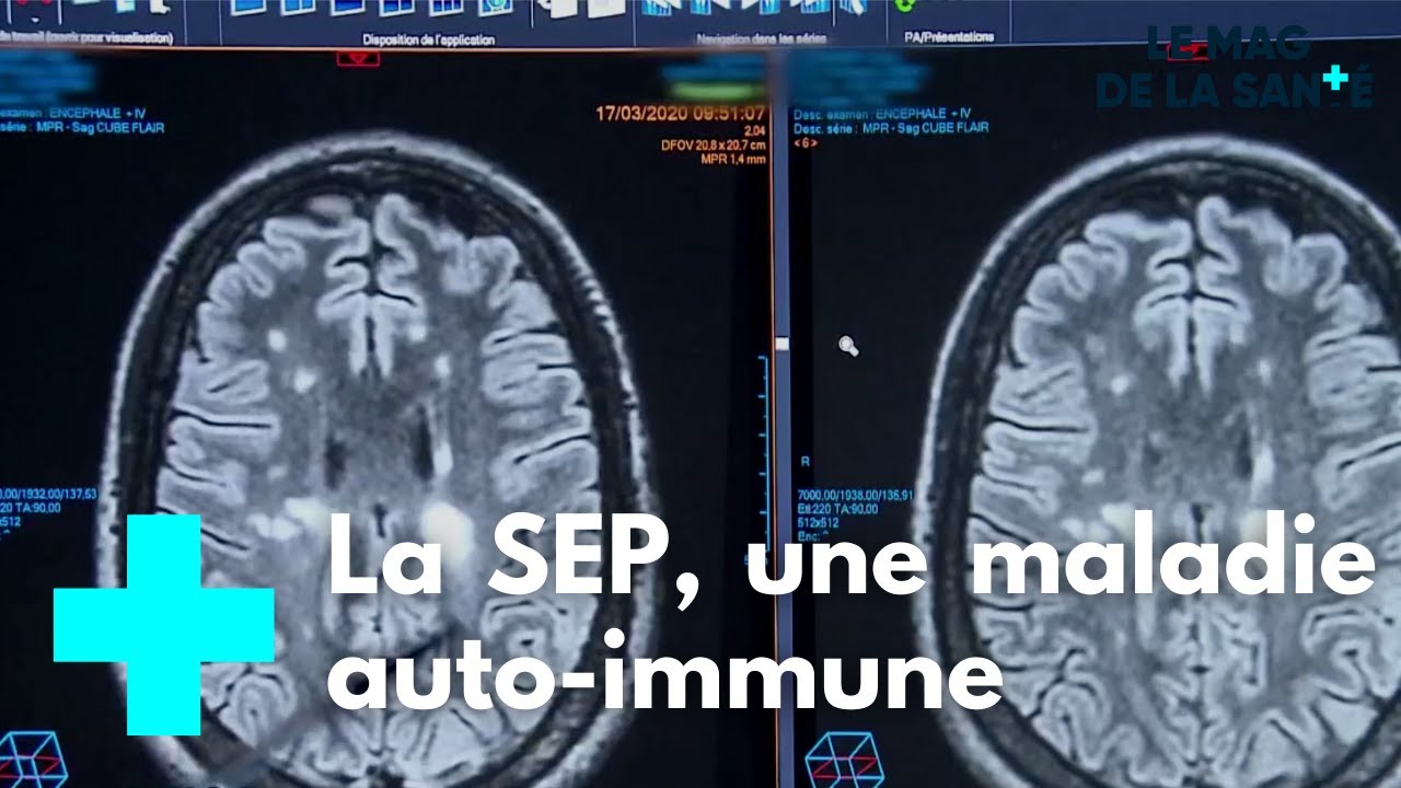 Combattre la sclérose en plaques 1/5 - Le Magazine de la Santé