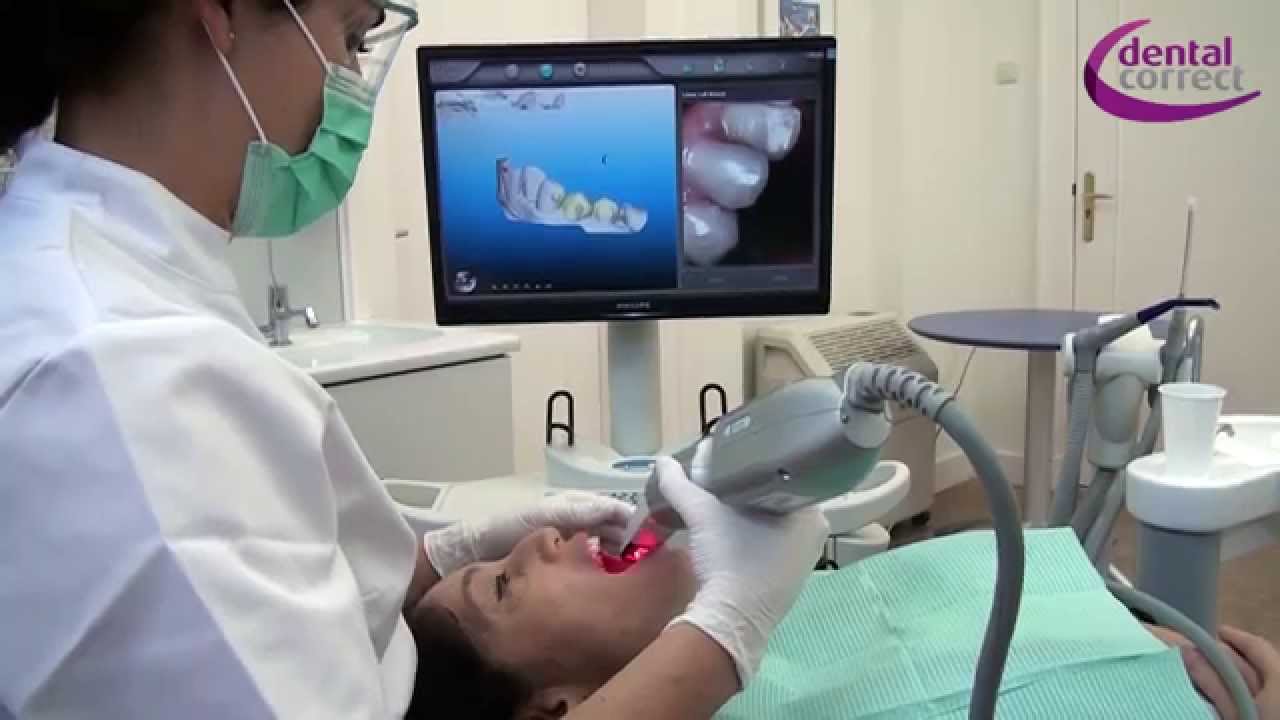 Procedure Invisalign Onzichtbare beugel
