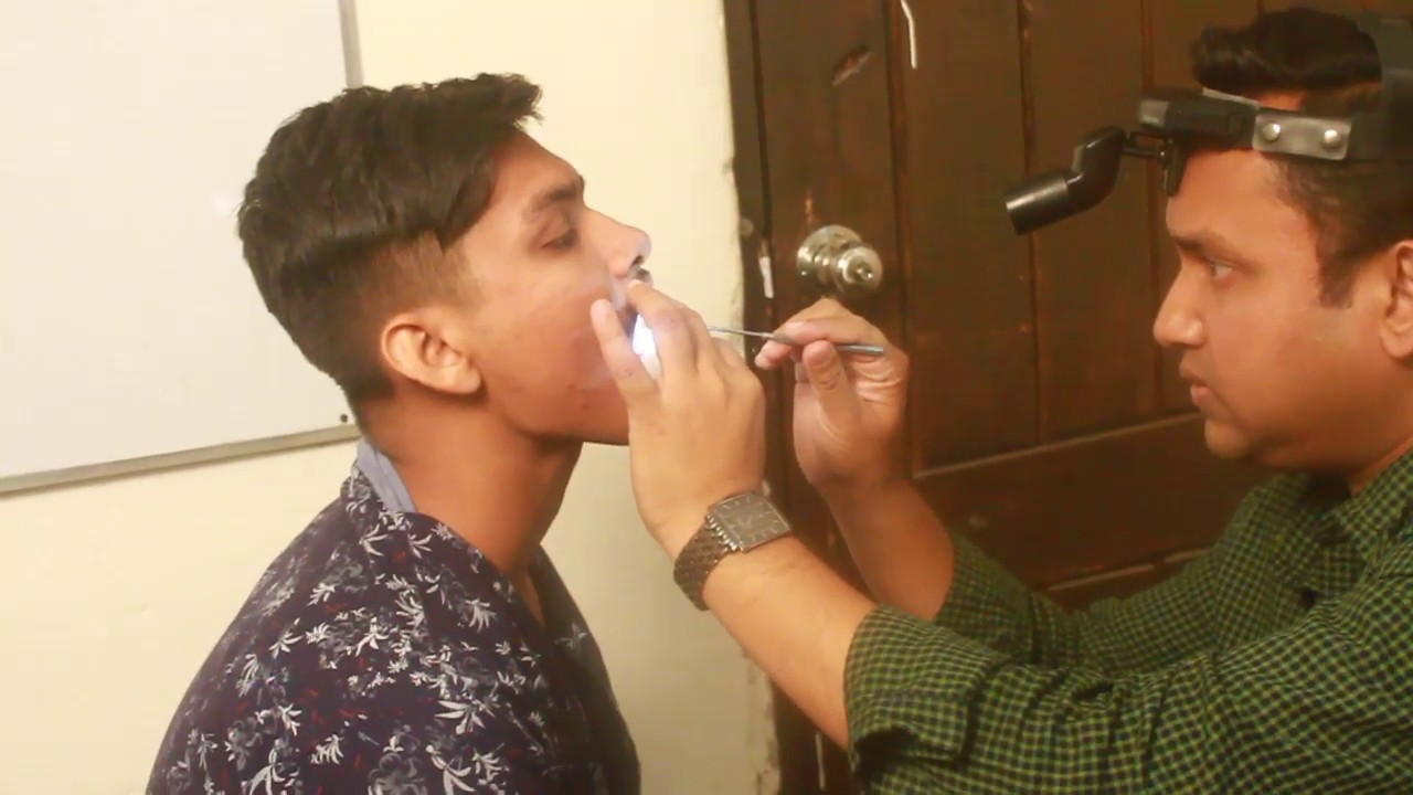 Oral Cavity Examination (in case of Chronic tonsillitis)