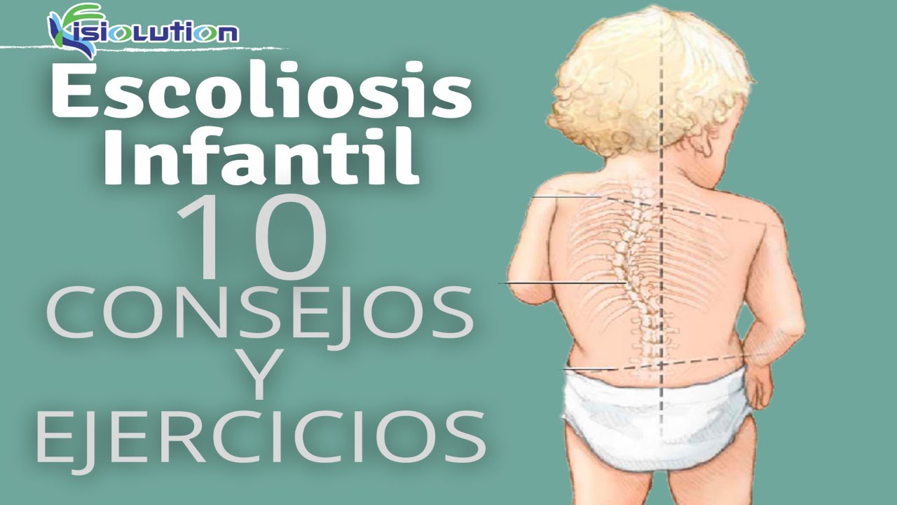 ¿Cómo EVITAR la ESCOLIOSIS INFANTIL? 10 RECOMENDACIONES y EJERCICIOS | Fisiolution