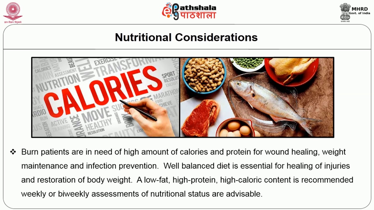 Dietary management in Burns