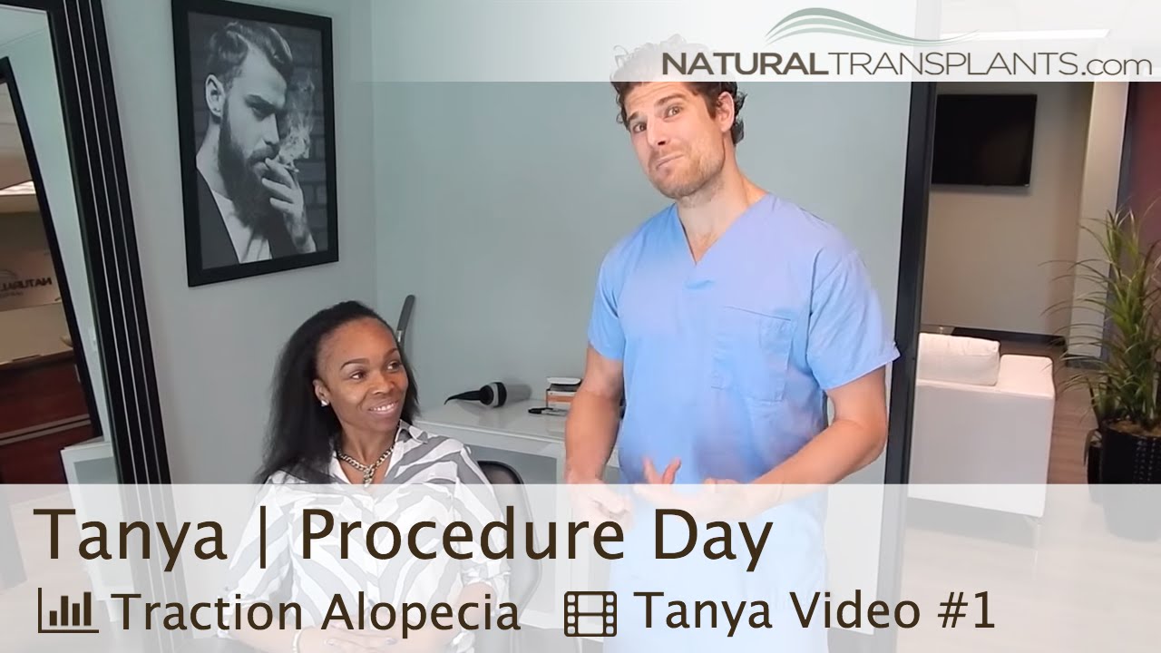 Female Hair Transplant & Hair Loss in Women - Natural Transplants, Hair Restoration Clinic (Tanya)