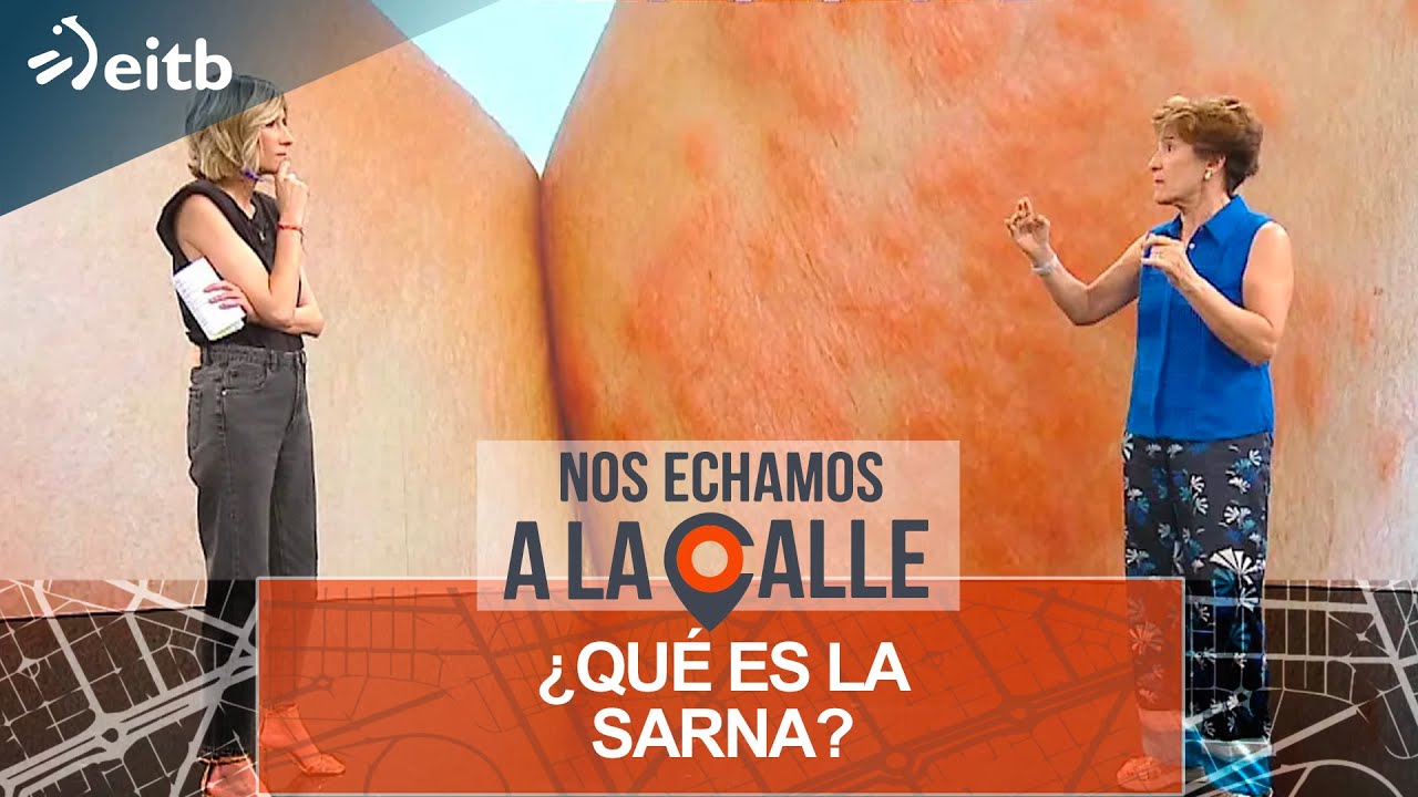 ¿Qué es la sarna? ¿Cómo se contagia? ¿Cuál es el tratamiento?