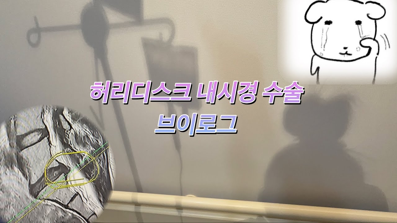[Vlog] 먹기만 하는 20대 허리디스크 수술 브이로그 | 양방향 척추 내시경 수술 | 소리가 좀 커요..ㅎ