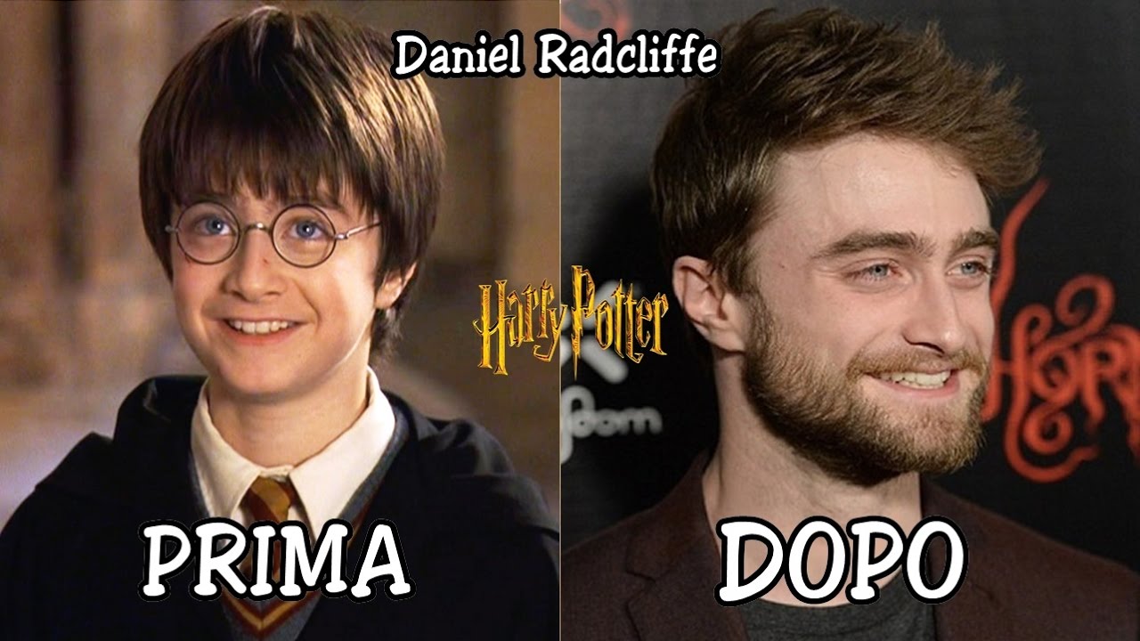 Harry Potter Prima e Dopo 2017