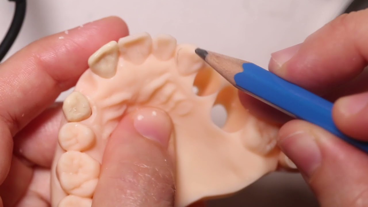 Encerado anterior sobre Modelo de Geller