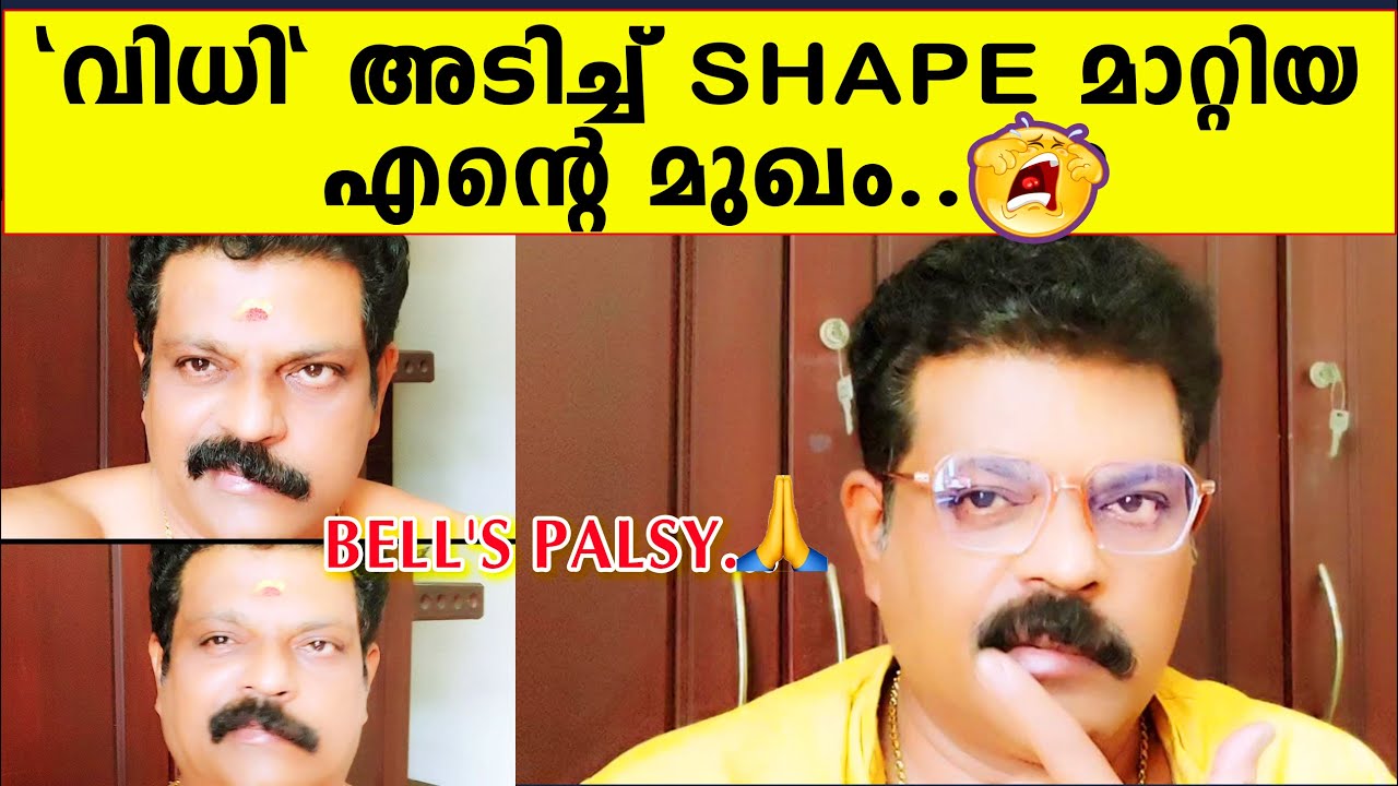 വിധി അടിച്ച് shape മാറ്റിയ എൻ്റെ മുഖം | BELL'S PALSY | Actor ManojKumar
