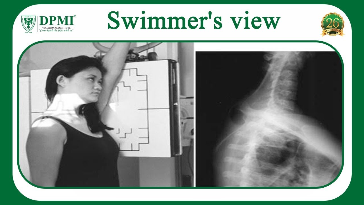 Swimmer's View: Why is Swimmers View Used? Cervicothoracic Swimmer's View X-ray (SVXR)