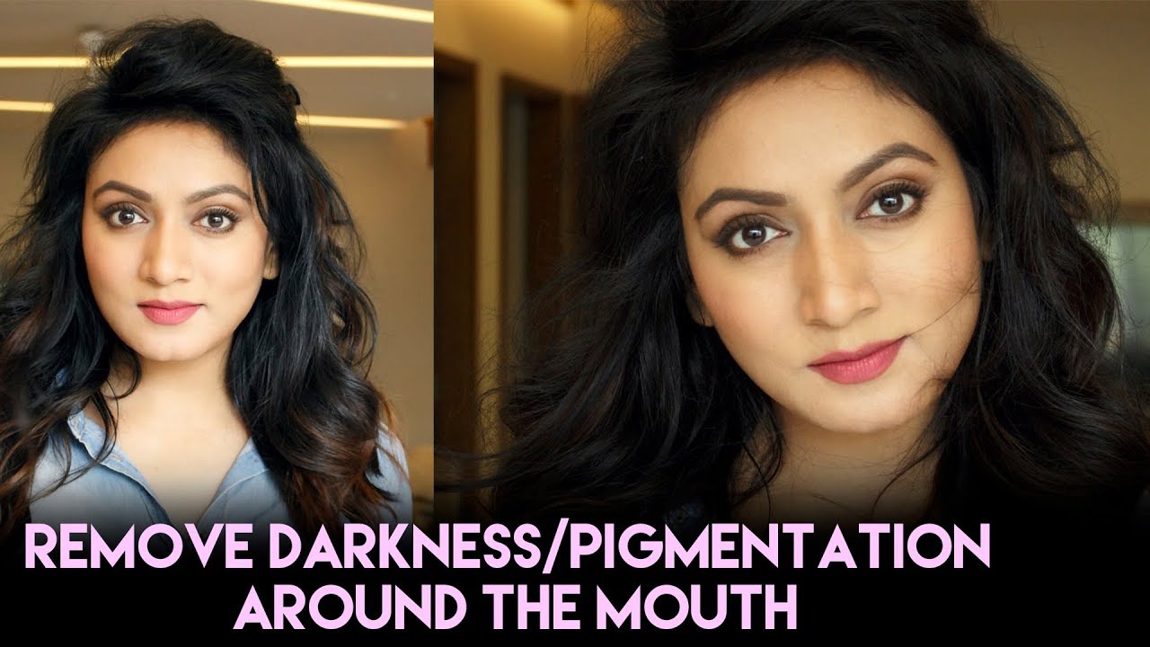 How To - Remove Darkness and Pigmentation Around The Mouth || Easy Home Remedies|| Ashtrixx