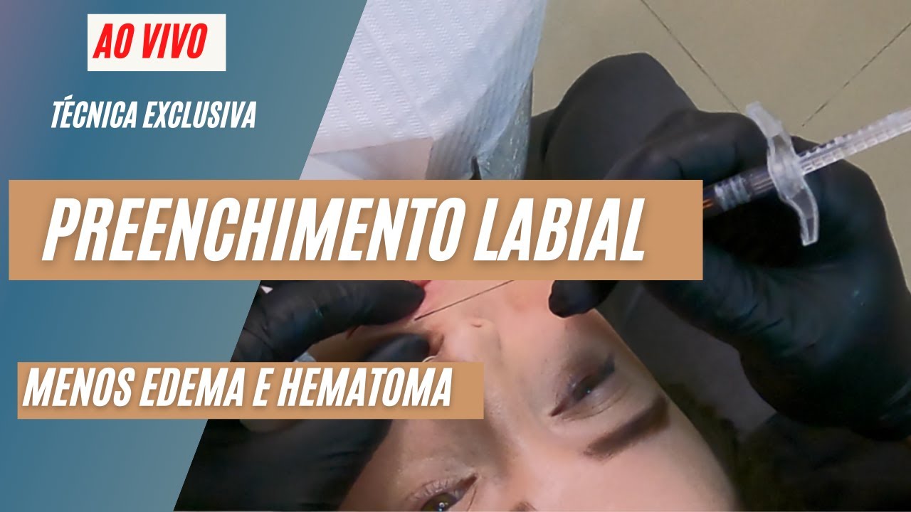 preenchimento labial - AO VIVO