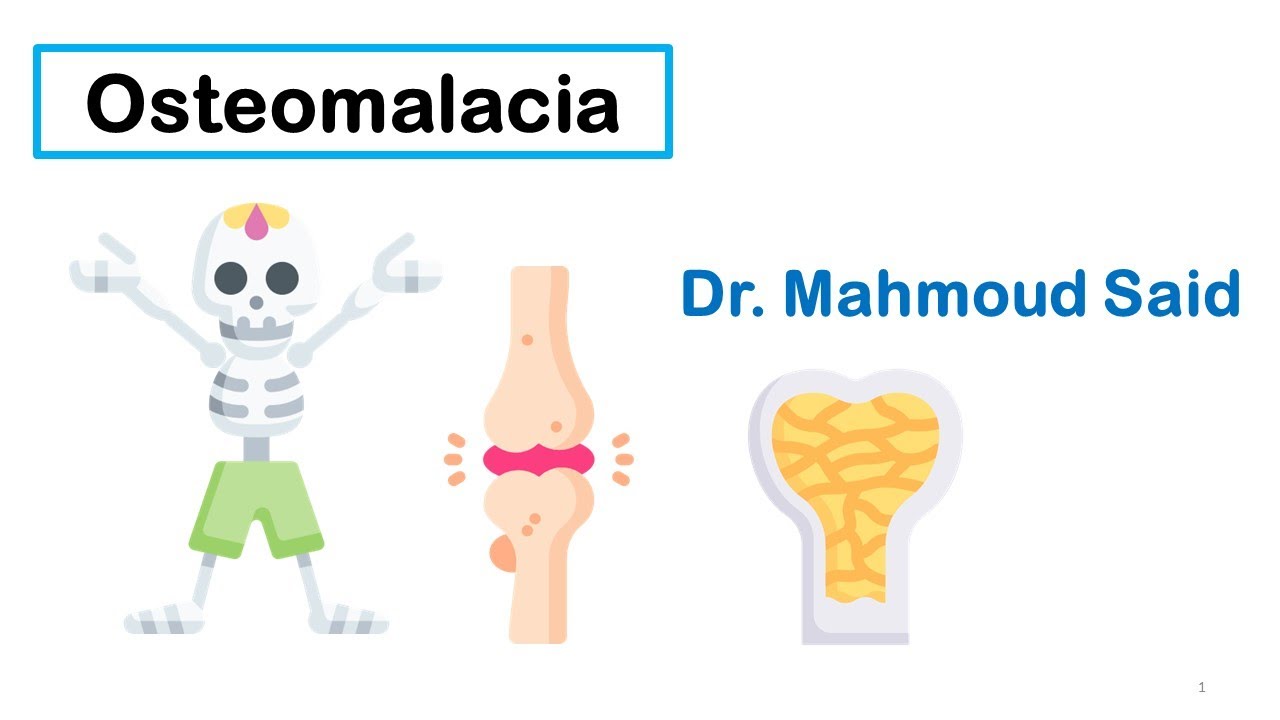 Bone Disorders-5- Osteomalacia- Adult Still Disease لين العظام  داء ستيل البادئ في البالغين