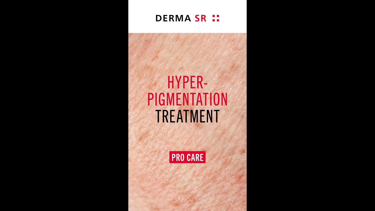 Hyperpigmentation Pro Care Behandlung with Derma SR