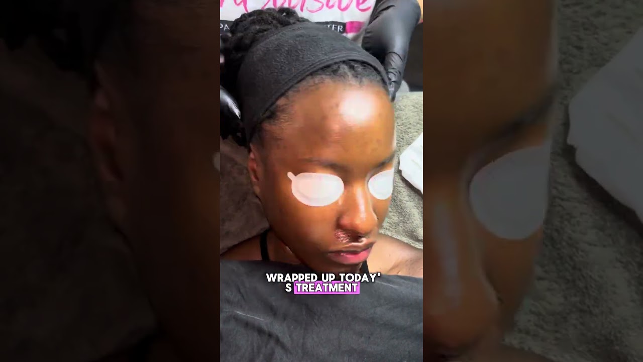 Professional Facial Tutorial: Boosted Enzyme with Lactic Peel