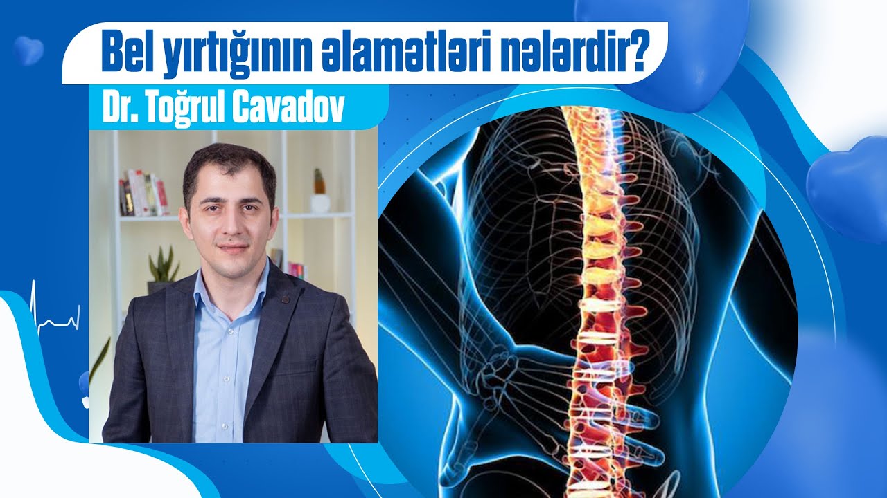 Bel yırtığının əlamətləri nələrdir?