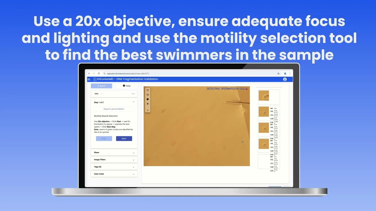 How-To: VitaMD Sperm Selection Tool