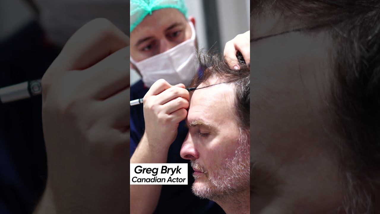 Greg Bryk Chooses Hermest Clinic for Hair Transplant! #HairTransplantIstanbul #HairTransplantTurkey