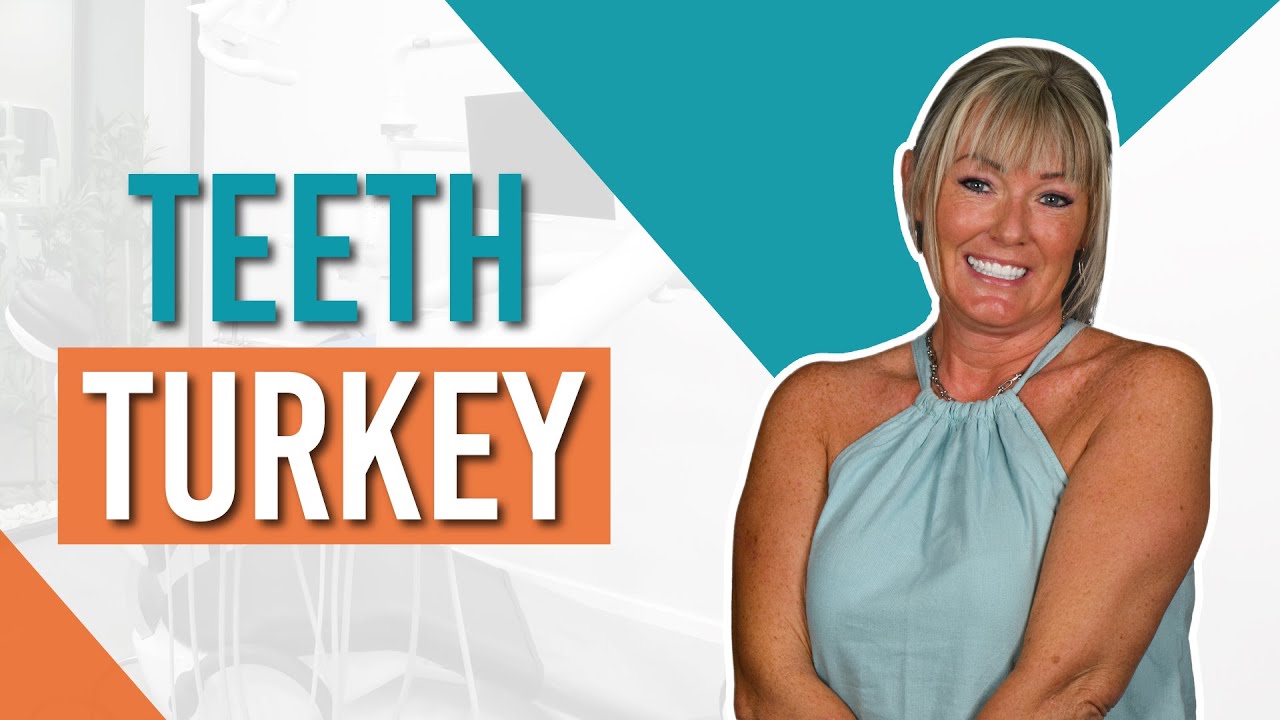Turkey Teeth Excellence: Corinne's Smile Transformation in Dentares Antalya Turkey