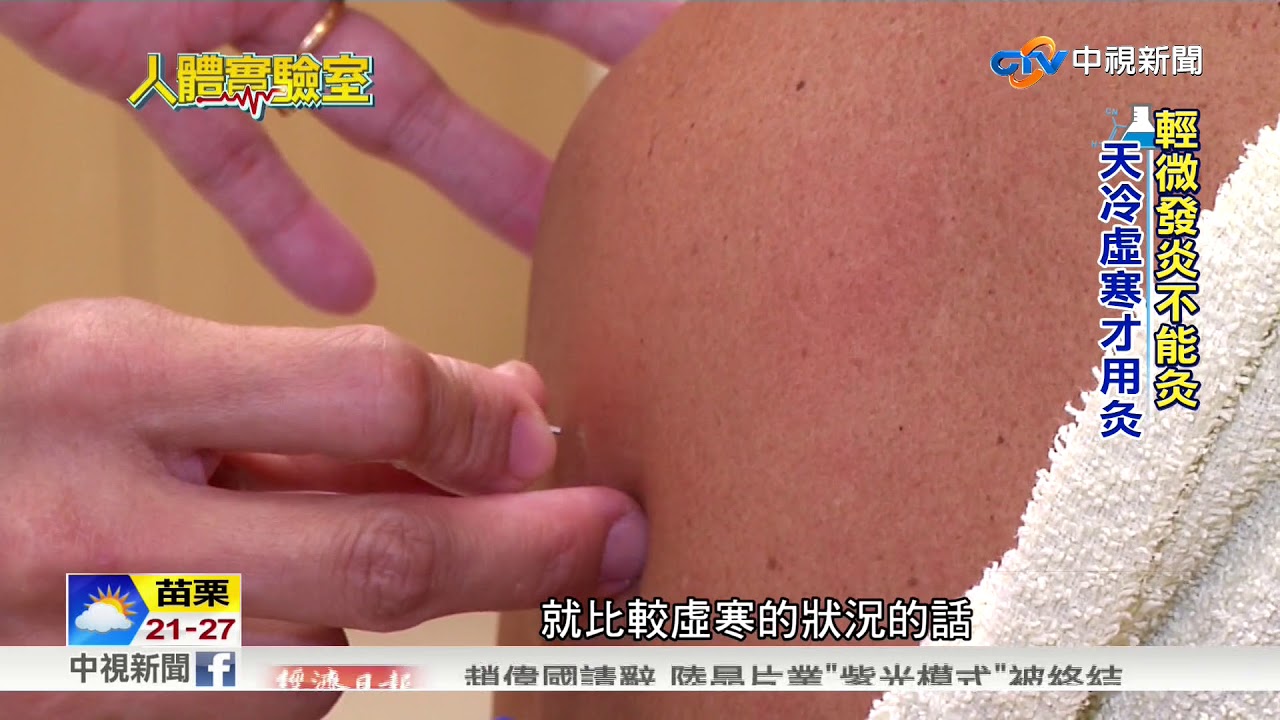 人體實驗室~遠紅外線+針灸 舒緩眼澀肩膀痛│中視新聞20180410