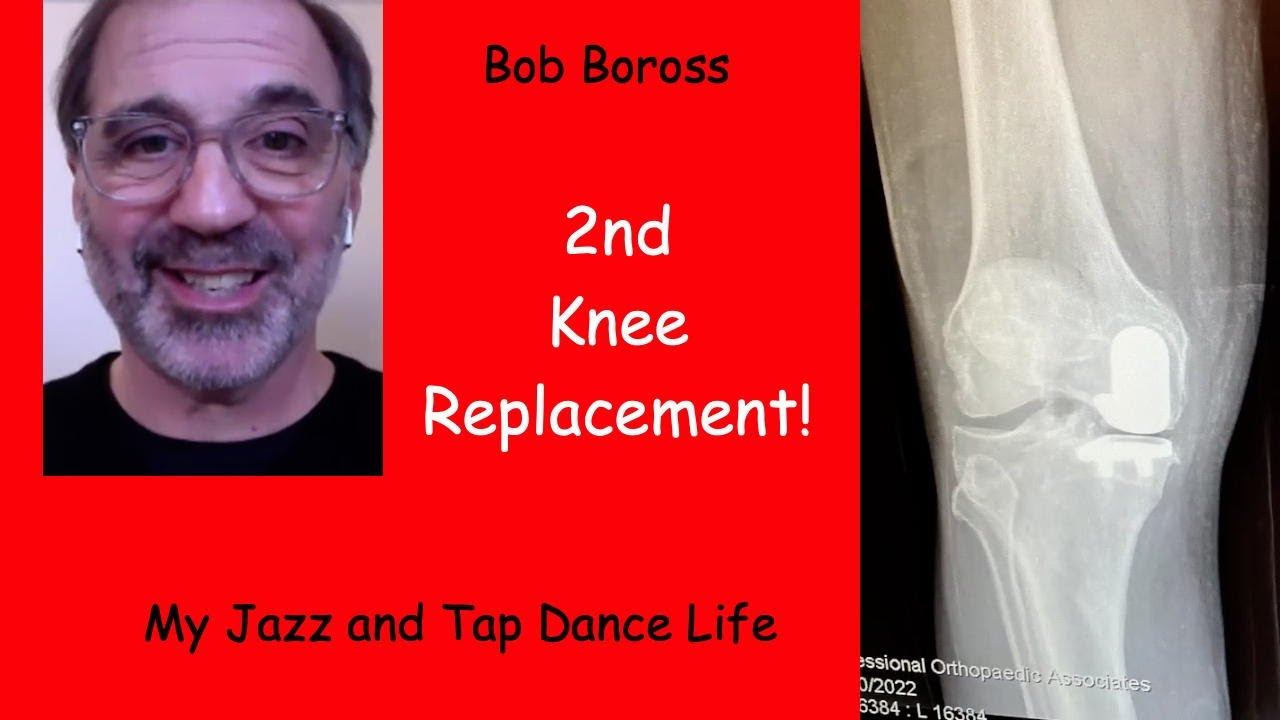 Bob Boross - Second Knee Replacement Update