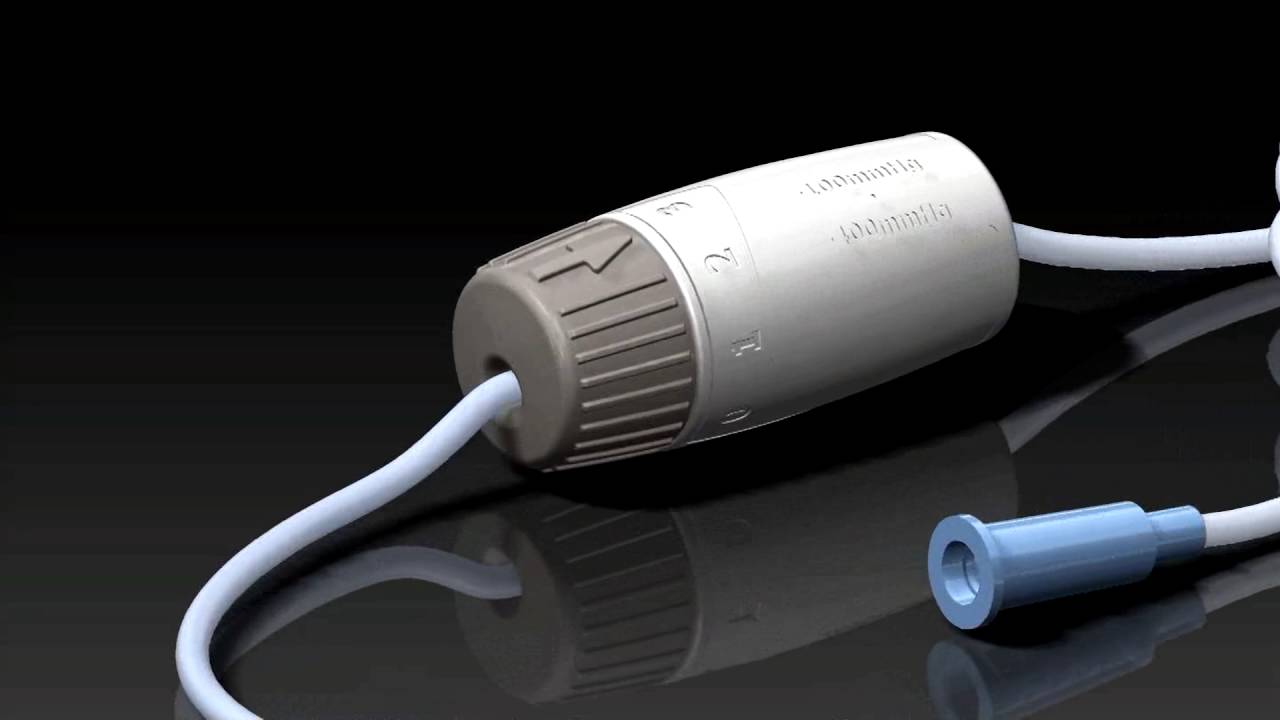 Buffalo Filter's PlumePort® ActiV® Laparoscopic Plume Filtration Device