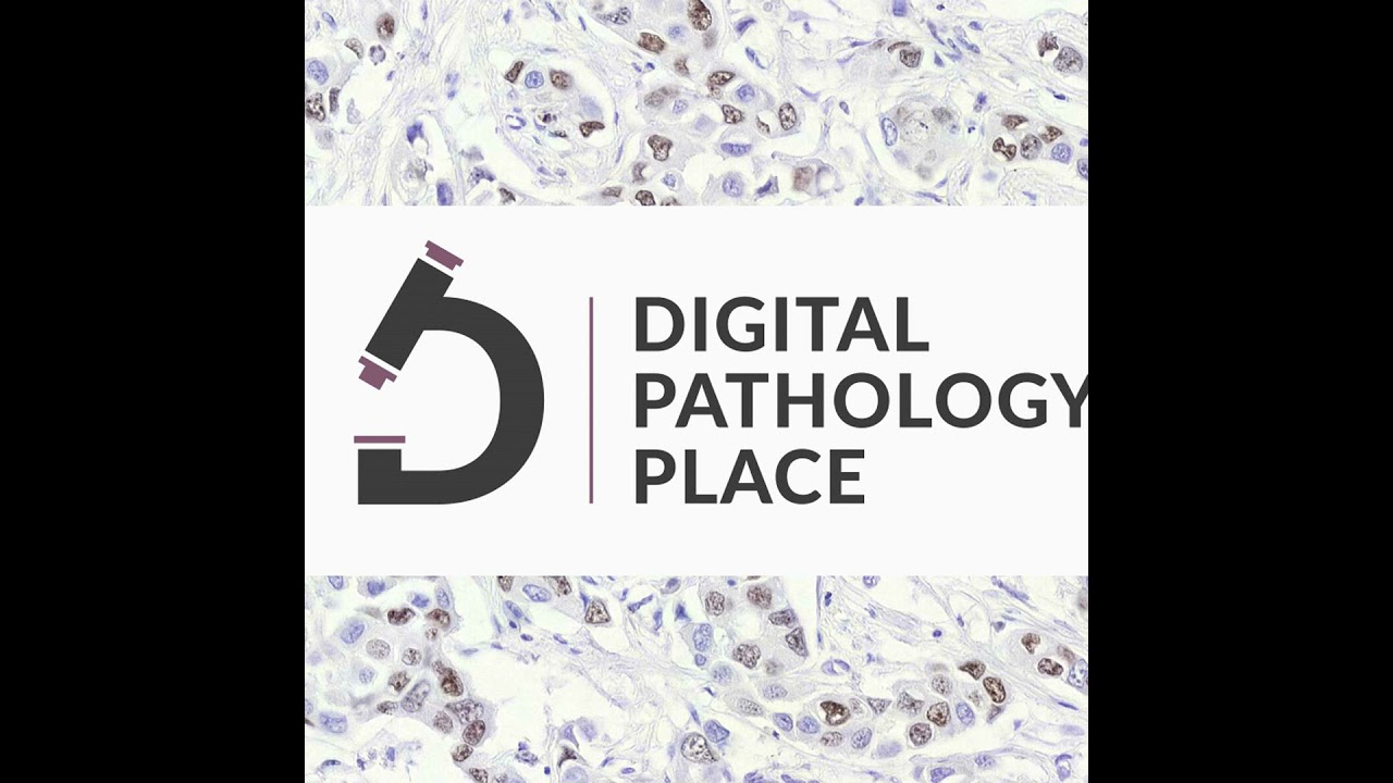 62: Changing Stereotypes of Pathology. How Pathologists Contribute to Patient Care w/ Marilyn Bui...