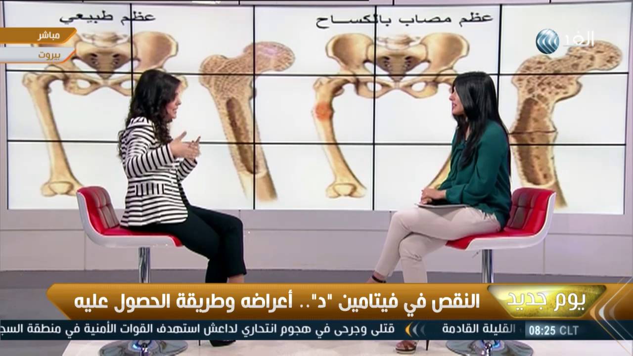 يوم جديد: أعراض نقص فيتامين 