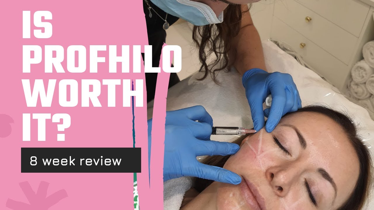 Profhilo: мошенничество или спасение?