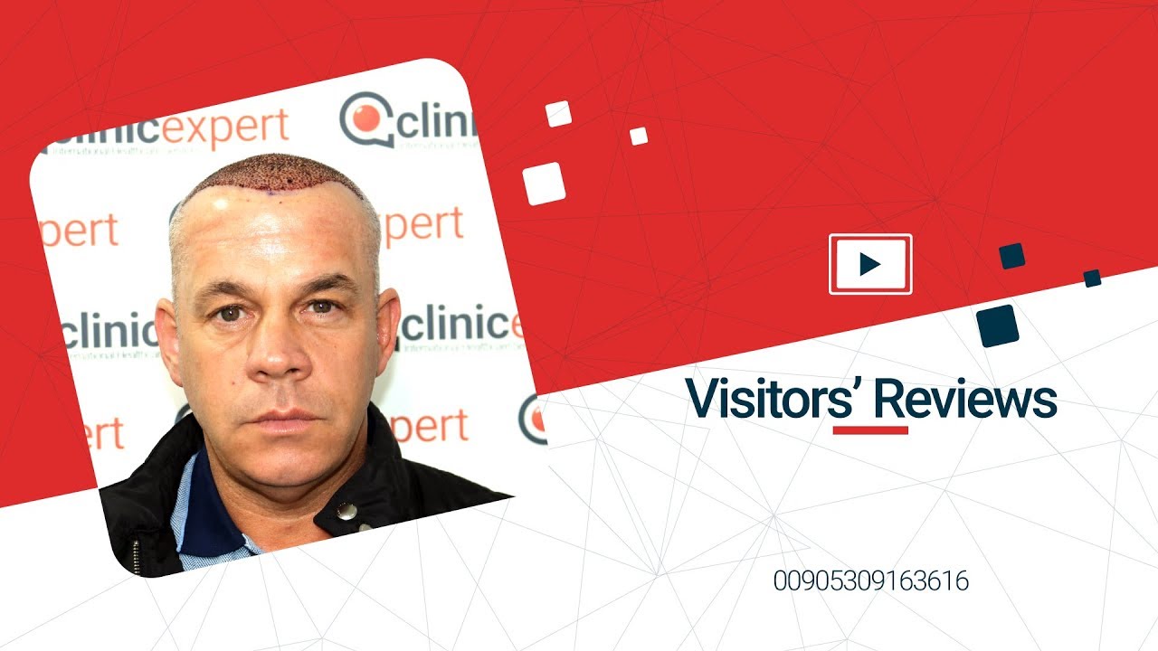 Hair Transplant In Turkey at Clinicexpert - Visitor's Review