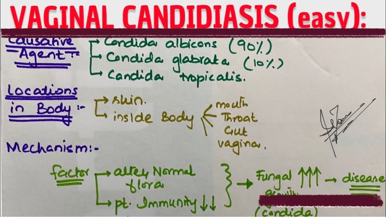 VAGINAL CANDIDIASIS | MEDICINE with DR SHAMAMA.