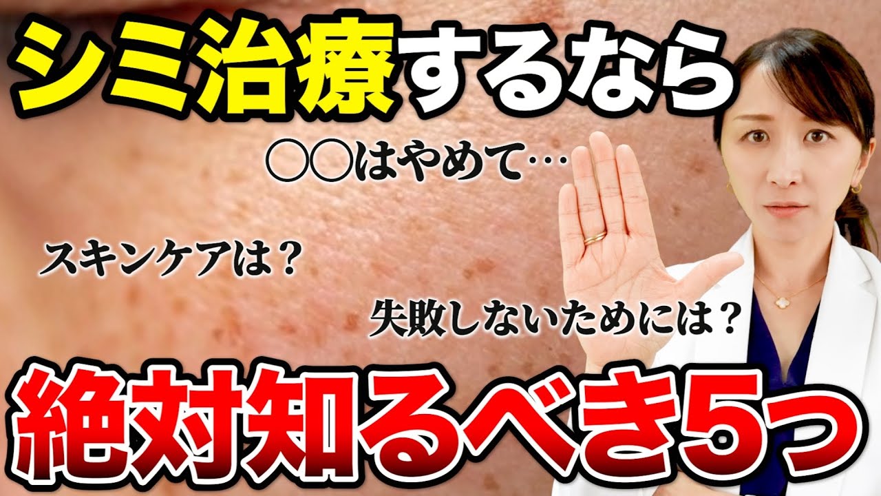 【これだけは知っておいて】シミ治療を失敗しないために絶対知っておくべきポイントを5つ、皮膚科医が解説