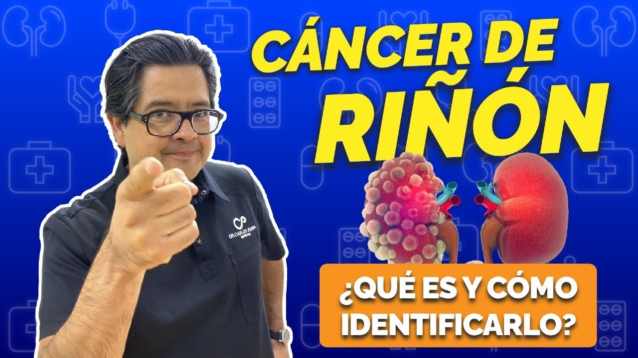 Cáncer de riñón ¿Qué es y cómo identificarlo?