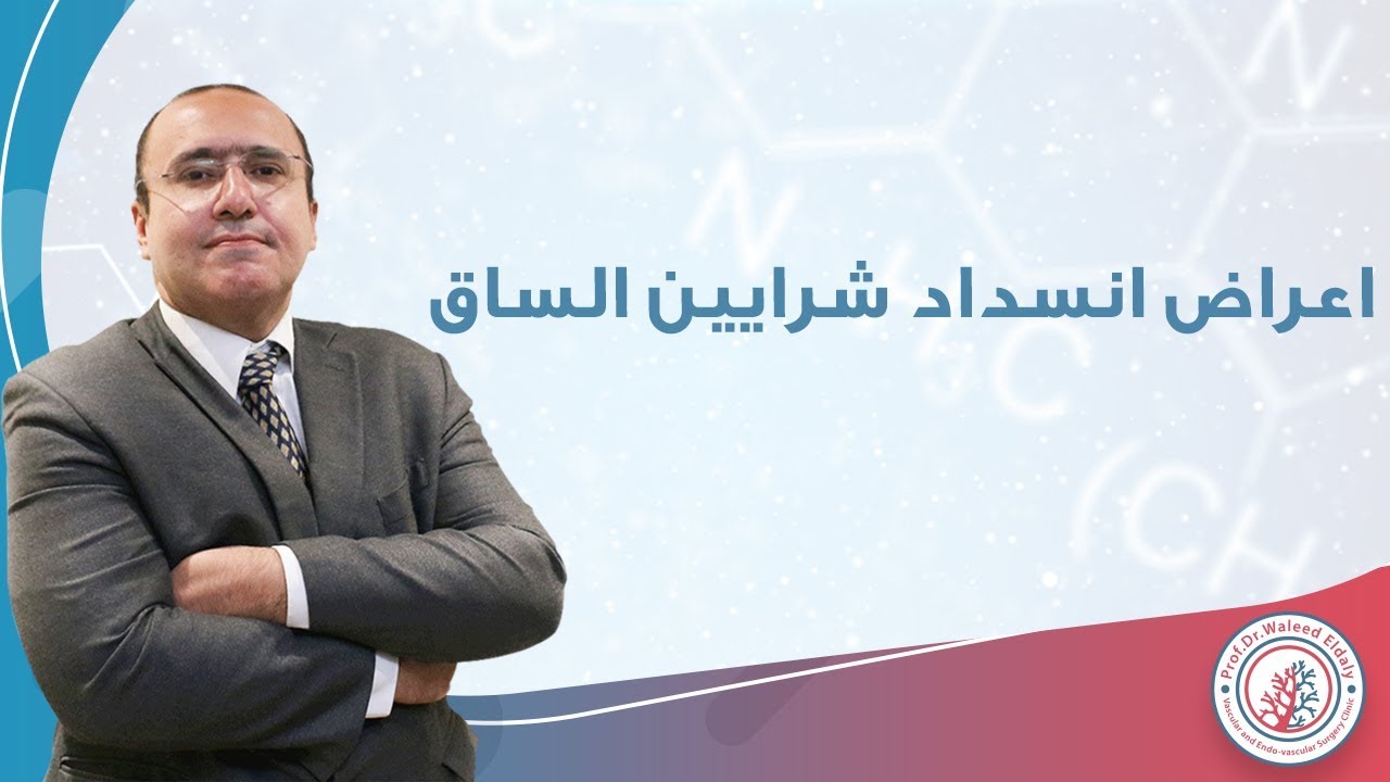 اعراض انسداد شرايين القدم ومتى يجب عمل توسيع لشرايين الساق | دكتور وليد الدالي