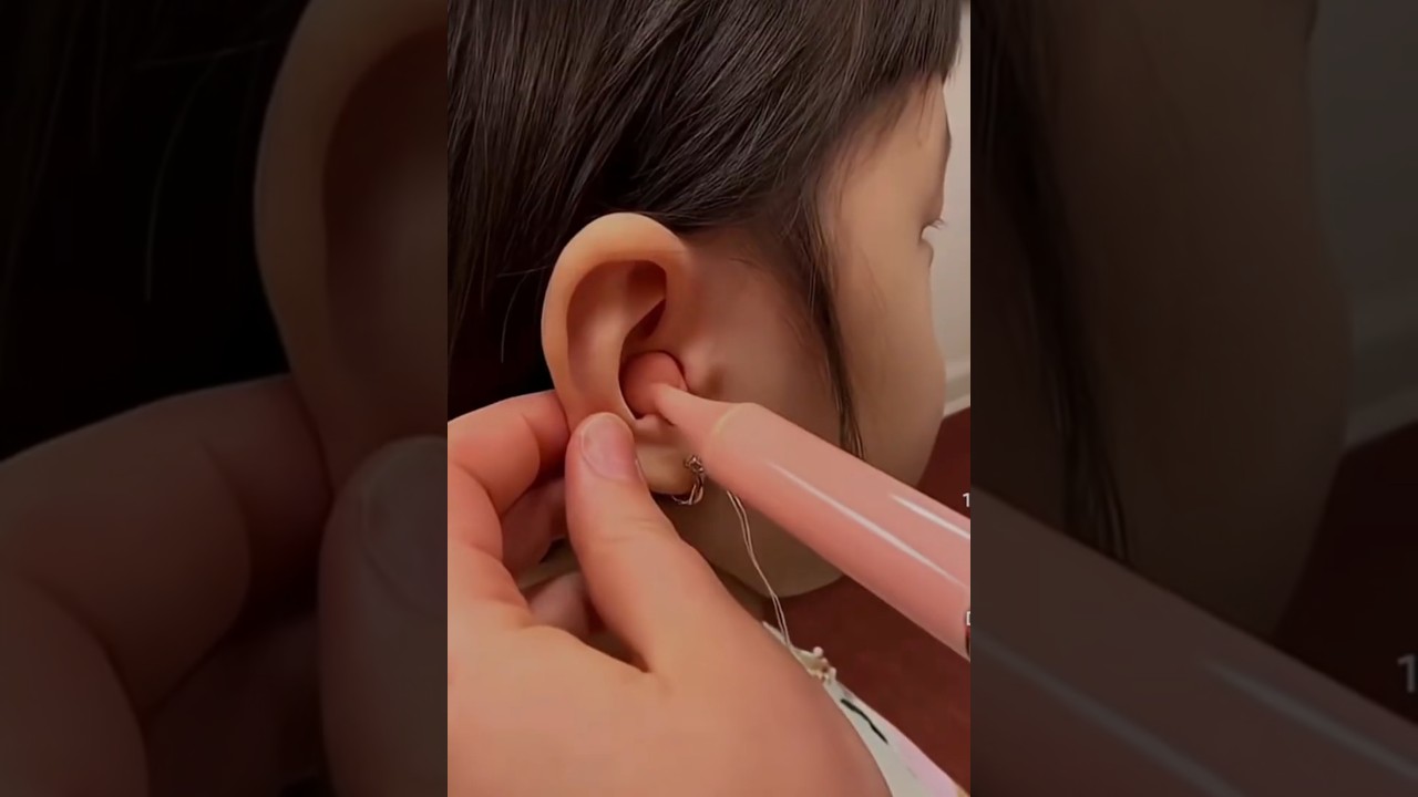 custom ear bud cost 10,000$ 