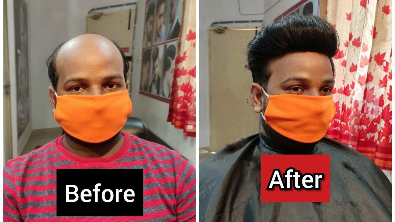 Hair Wigs in Lucknow,hair patch in lucknow अब कैसा गंजापन,सबसे सस्ते हेयर विग्स7651862613,7355087241