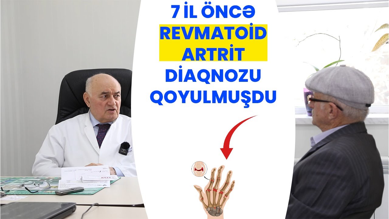 7 İL ÖNCƏ REVMATOİD ARTRİT DİAQNOZU QOYULMUŞDU