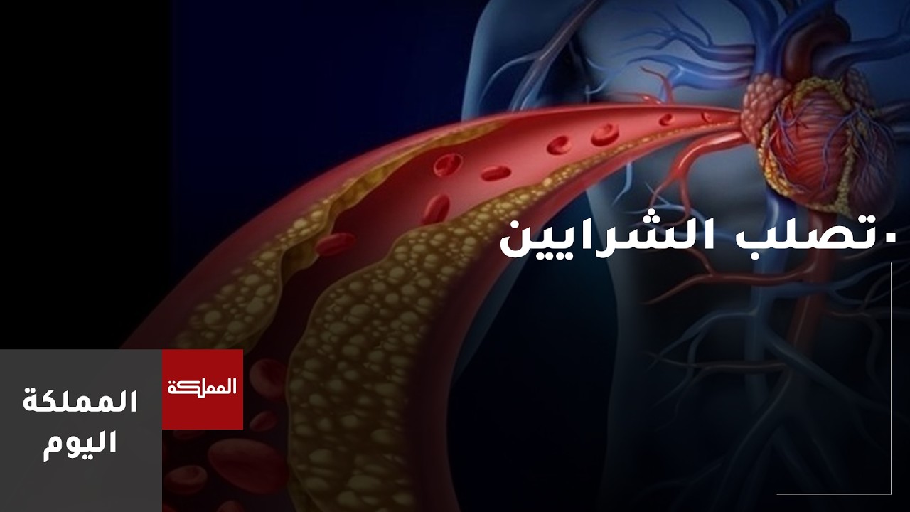 علامات مبكرة تشير إلى وجود تصلب في الشرايين