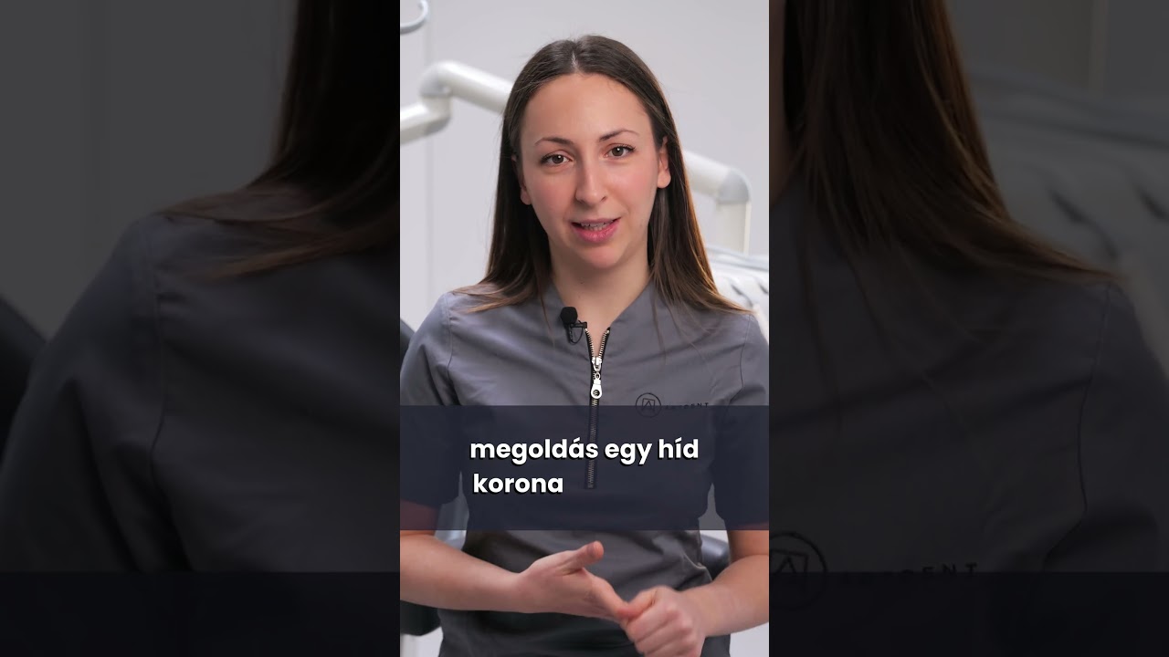 ✨ &Uacute;j &eacute;s gy&ouml;ny&ouml;rű mosoly, mind&ouml;ssze n&eacute;h&aacute;ny nap alatt 🦷 - Artdent Fog&aacute;szat
