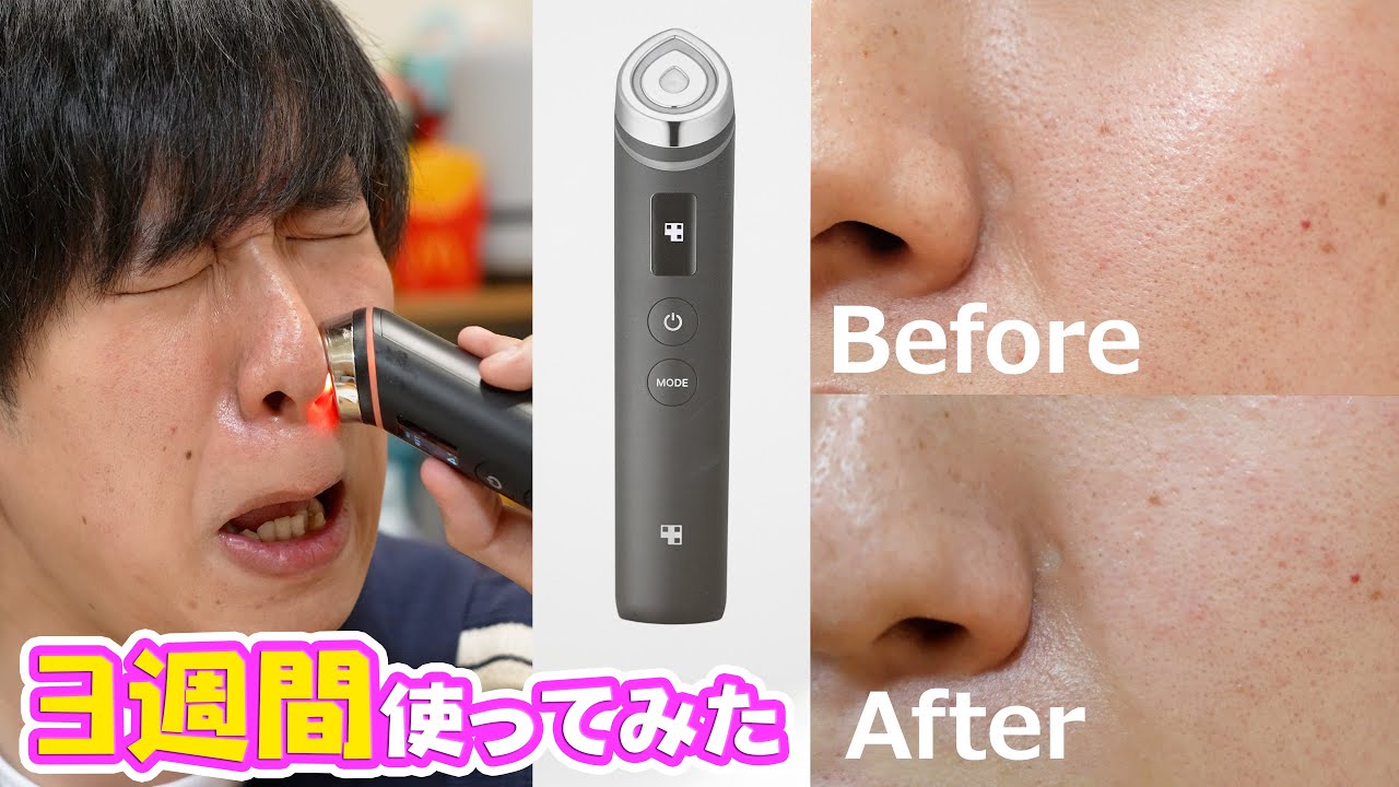 【正直レビュー】毛穴が小さくなる人気の商品がヤバかった。【#月1ご褒美 】