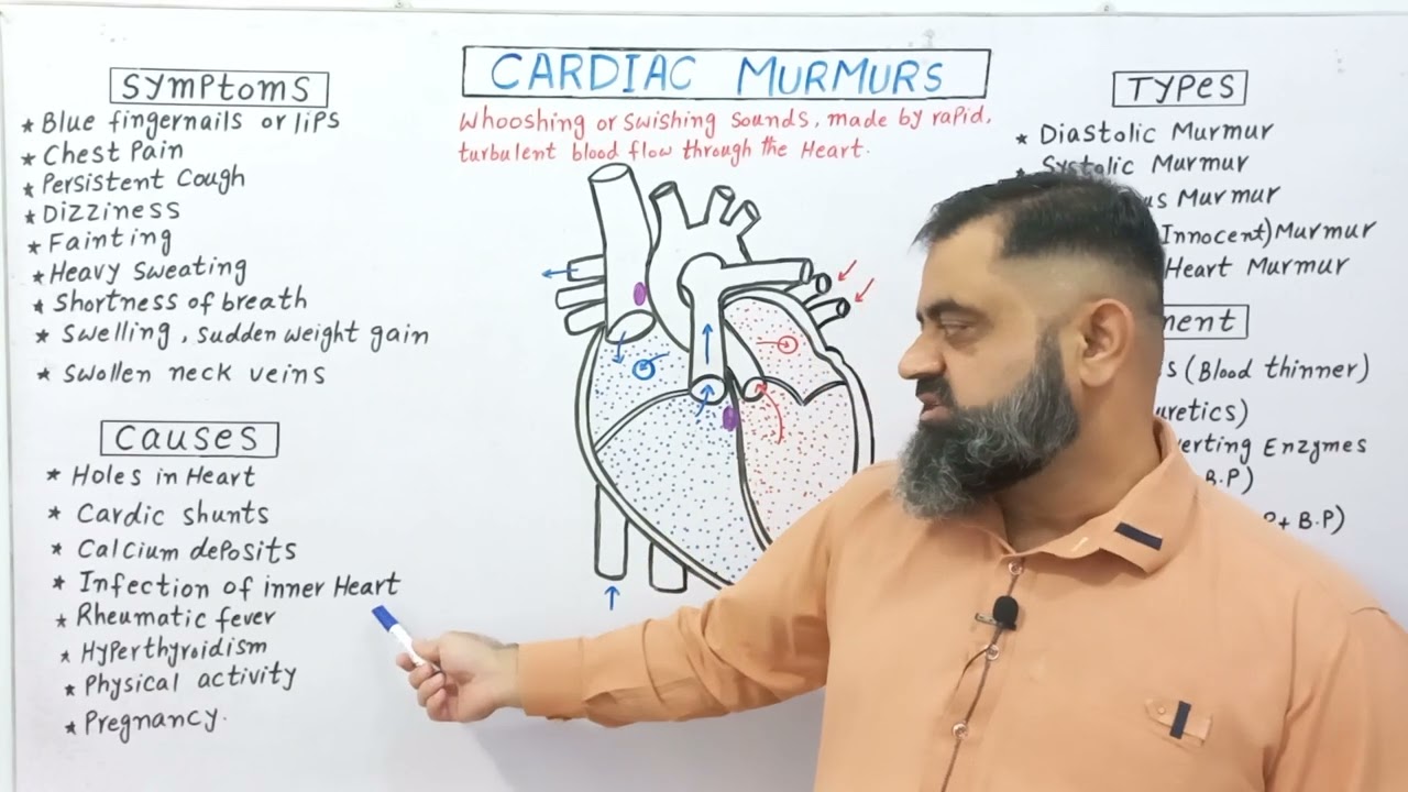 Cardiac Murmurs Urdu/Hindi medium @ Prof Masood fuzail #heartmurmur #heartsounds #systolicmurmur
