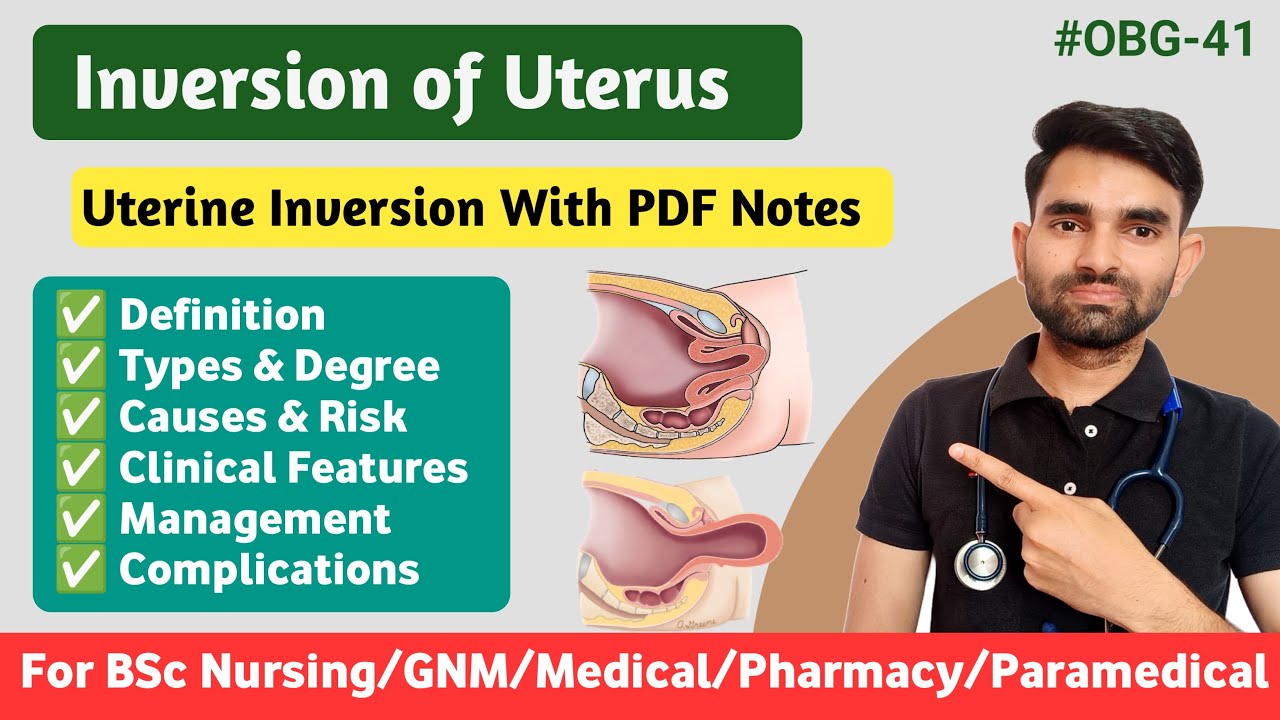 Inversion of Uterus in Hindi | Types, Causes, Symptoms And Management of Uterine Inversion
